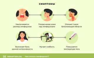 Гнойный лимфаденит: причины заболевания, диагностика и лечение