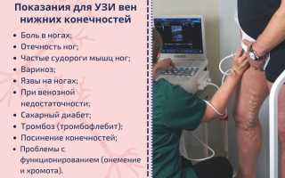 Дуплексное сканирование (УЗИ) вен нижних конечностей: возможности метода