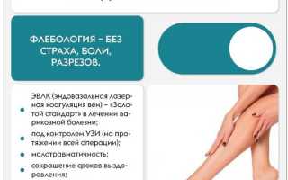 Флеболог: особенности специализации