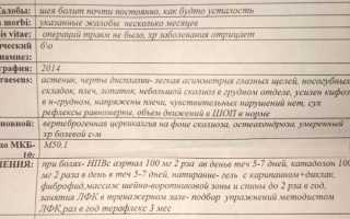 Мой личный опыт борьбы с шейным остеохондрозом