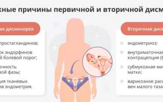 Дисменорея – болезненные менструации