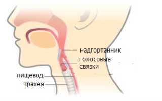 Почему после еды возникает икота