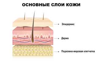 Пинта – редкое тропическое заболевание кожи