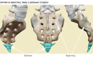 Чем опасен вывих копчика, и как лечатся после такой травмы?