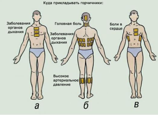 горчичники схема использования