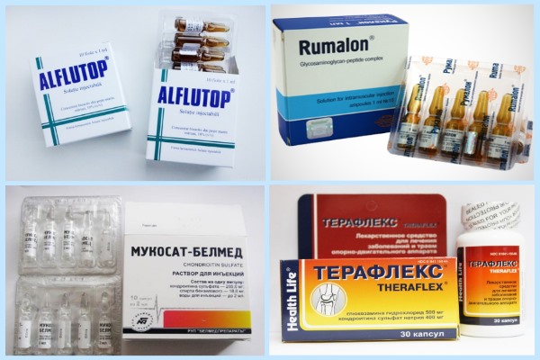 Хондропротекторы
