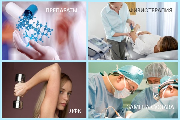 Методы лечения артрита локтя