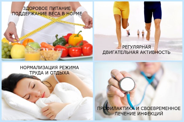 Правила профилактики артрита