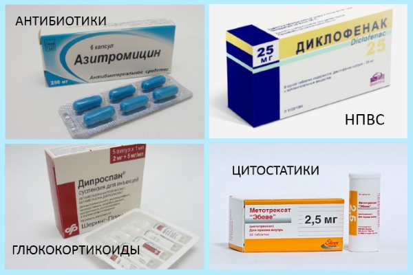 Препараты для лечения хламидийного артрита