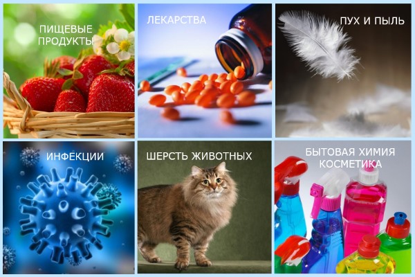 Причины аллергического артрита