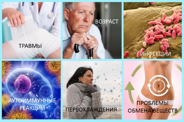 Частые причины артрита коленного сустава