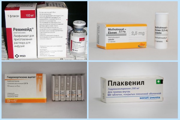 Противоревматические средства 