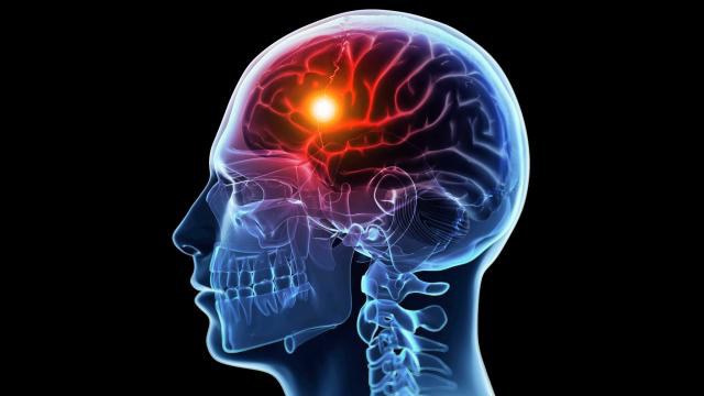 Голова, мозг и оранжевая точка