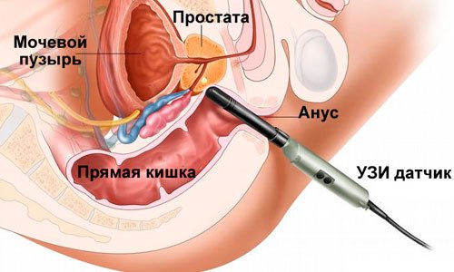 Проведение УЗИ у мужчин