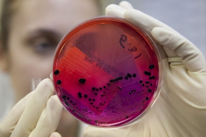 Возбудитель сибирской язвы