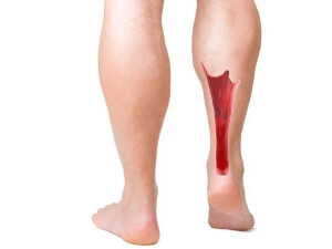 Ноги В задней части ноги