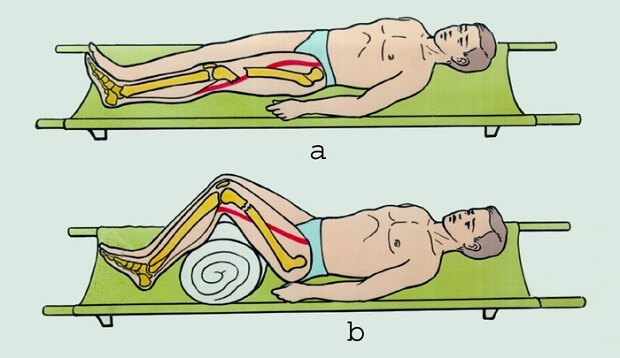 Перевозка Транспортировка пострадавшего