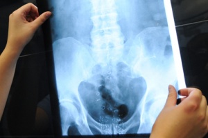 Снимок Рентген при паталогии