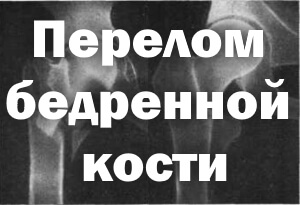 Снимок Рентген