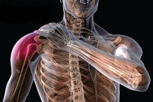 Боли в плечике Боли в плече