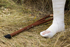 Гипс Наложенный гипс