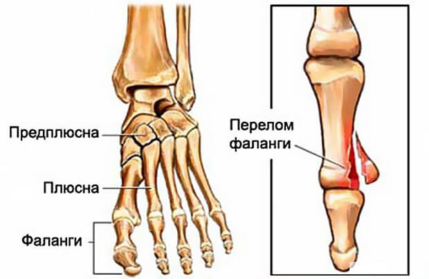 Как выглядит Повреждение