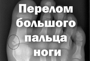 Снимок Рентген