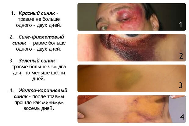 Заживает Заживление