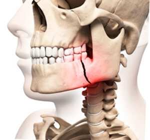 Травма Повреждение