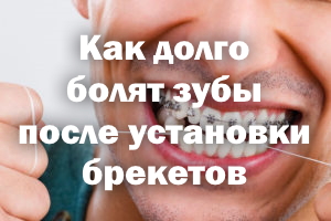 Как долго болят зубы после установки брекетов Как долго ноют зубы после установки брекетов