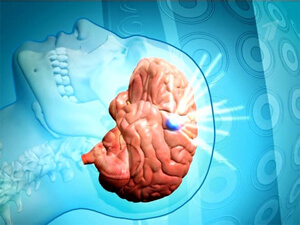 Терапия Что делается