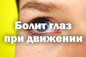 Болит глаз при движении Болит глазик при движении
