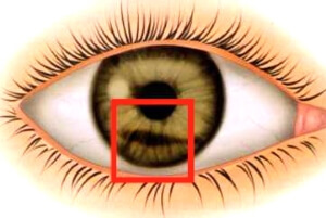 Предметами Тупые