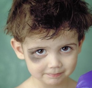 У детей Травмированность