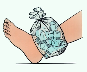 Компресс Холодный компресс