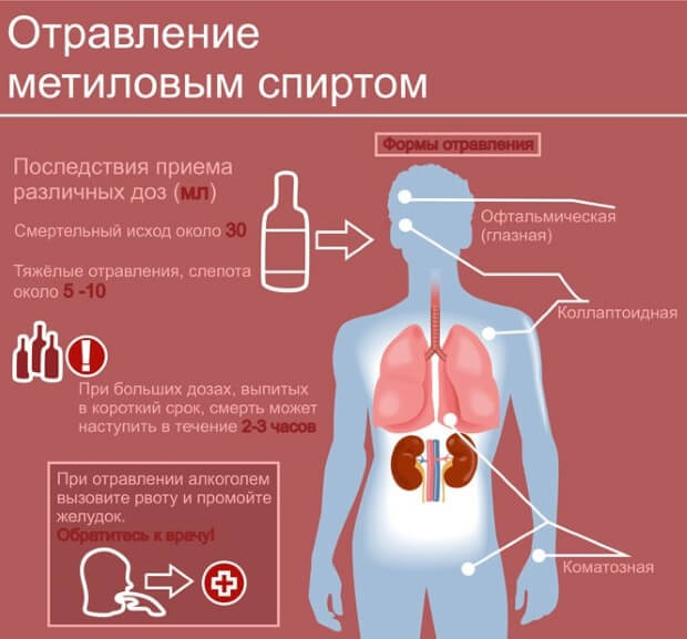 Отравился Отравление спиртом