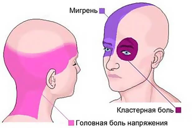 Какие бывают Виды