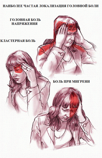 Какие бывают Виды