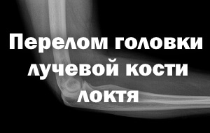 Как проводится лечение Лечение и восстановление