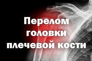 Перелом головки плеча Перелом головки плечевой кости