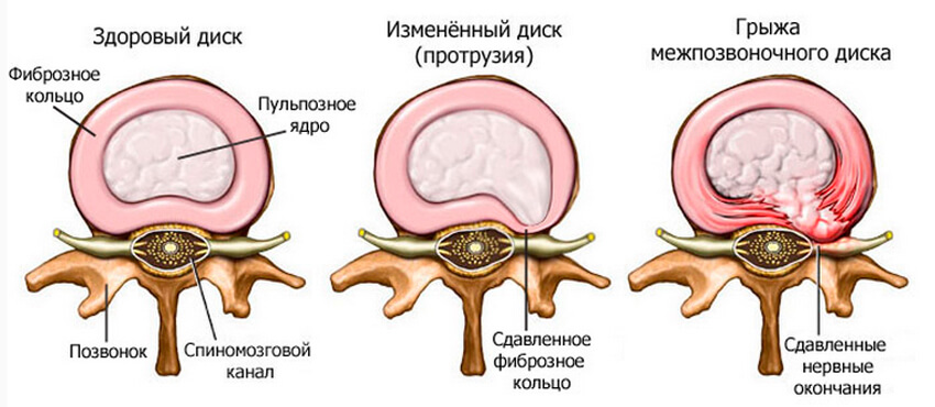 Признаки Эта проблема
