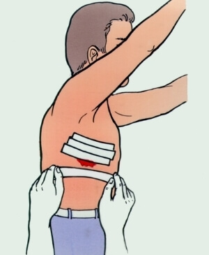 Первые действия Медицинская помощь