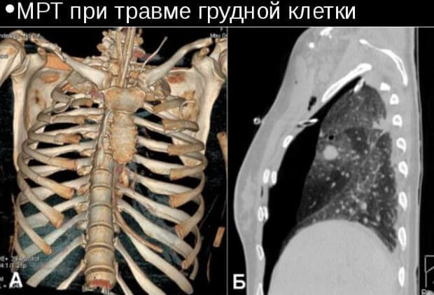 Исследование МРТ