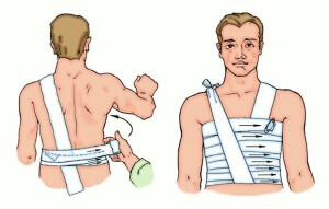 травмы грудной клетки