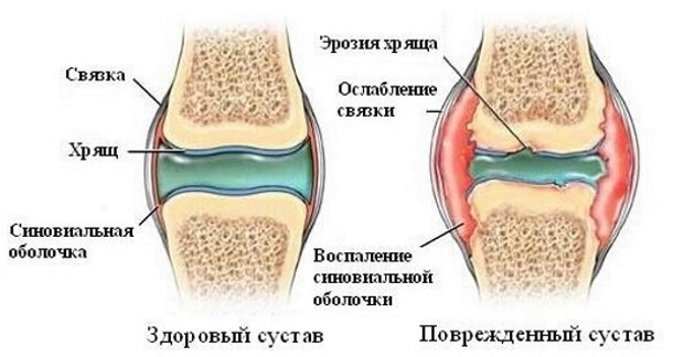 Сравнение Здоровый и поврежденный
