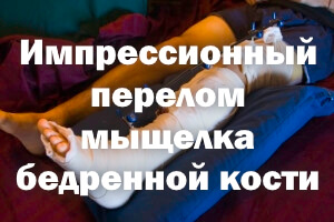 Импрессионный перелом мыщелка бедра Импрессионный перелом мыщелка бедренной кости