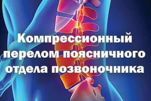 Компрессионный перелом позвоночника поясничного отдела Компрессионный перелом позвоночника поясницы