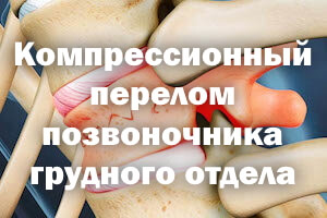 Компрессионный перелом позвоночника грудного отдела - лечение у взрослых Компрессионный перелом позвоночника грудного отдела - терапия у взрослых