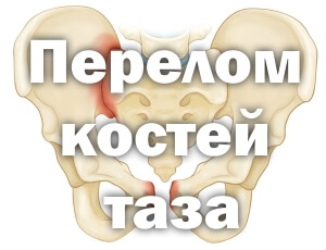 Как выглядят Схема