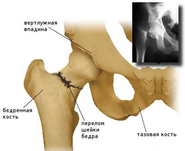 Травма Повреждение